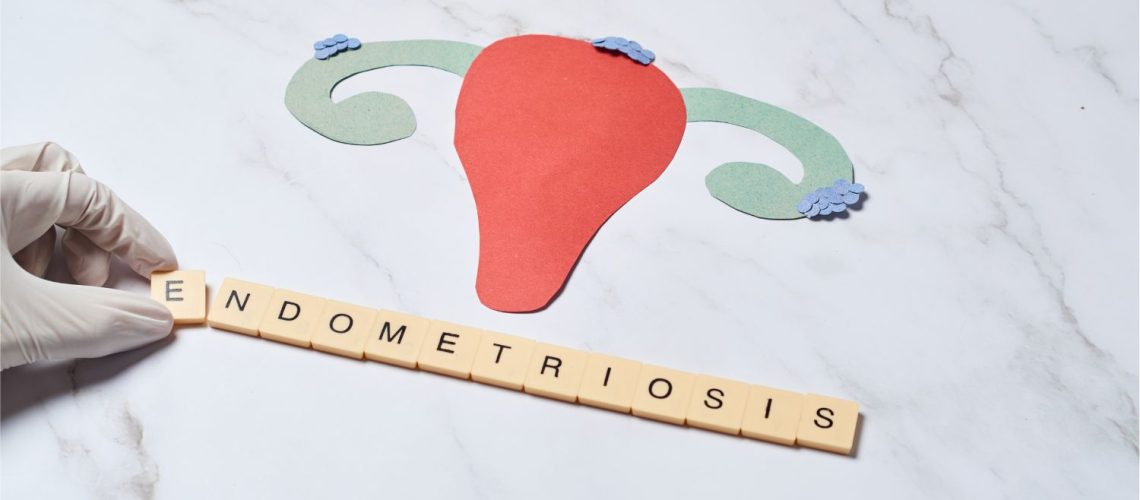 endometriosis endometriosis